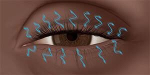 Lid twitch or flutter