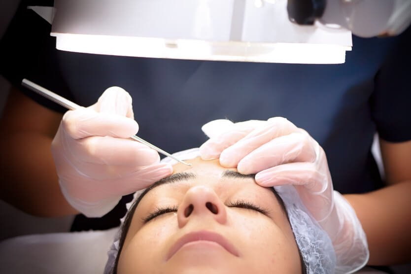 Oculoplastics surgery