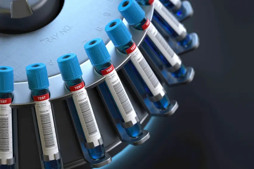 Autologous Serum Drops Save You from Dry Eyes 